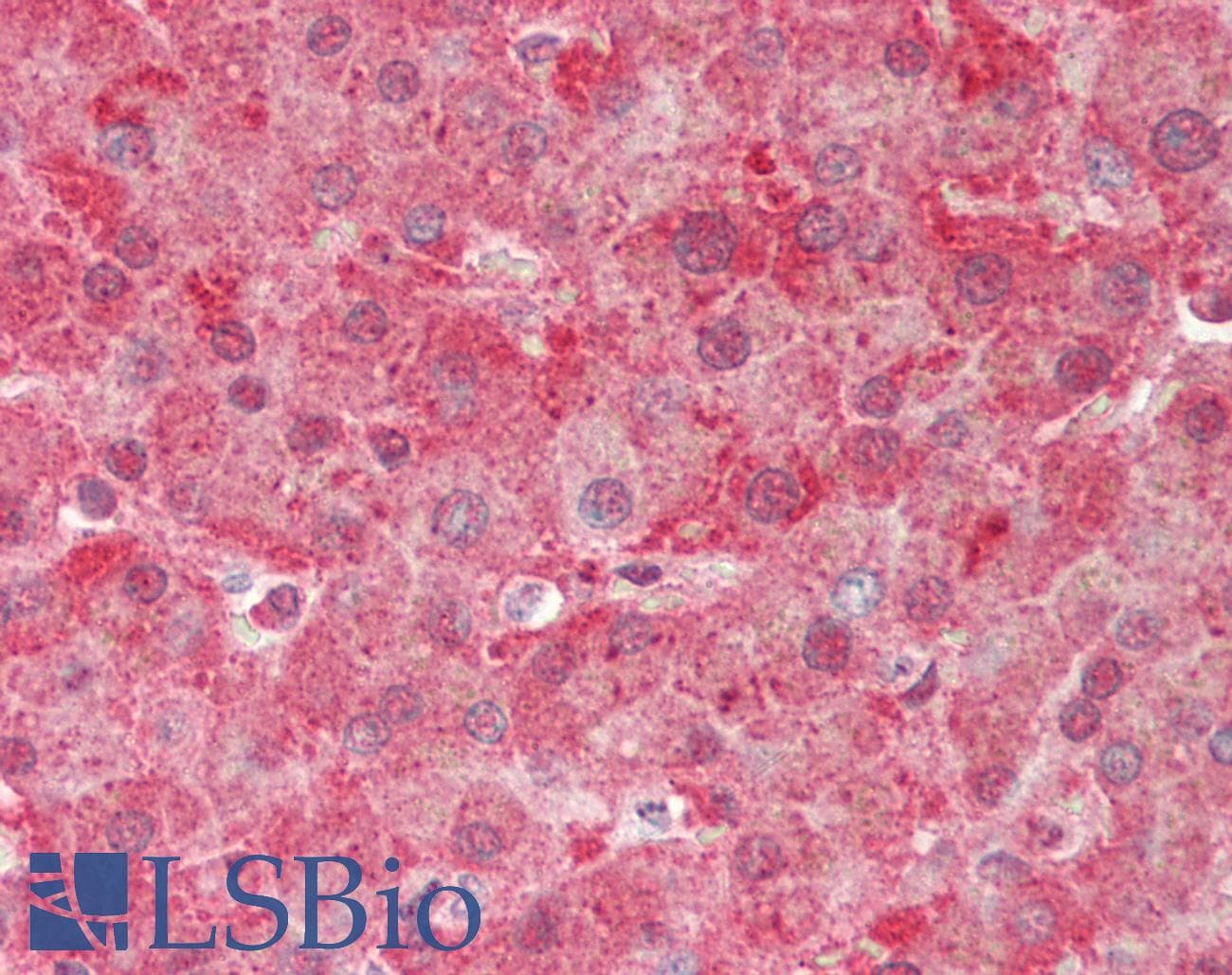 PathPlus™ Polyclonal Rabbit anti-Human APCS / Serum Amyloid P / SAP Antibody (IHC, WB)