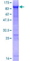 Human Alpha-Fetoprotein (Recombinant GST)