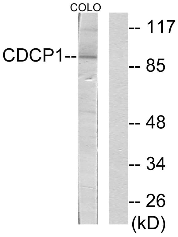 CDCP1 Antibody (aa691-740)