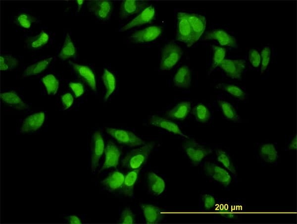 Monoclonal Mouse anti-Human EIF2AK2 / PKR Antibody (clone 1B9, IF, WB)
