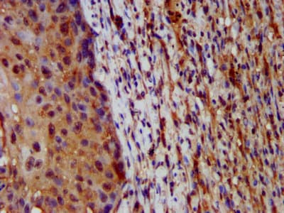 HAL / Histidine Ammonium Lyase Antibody