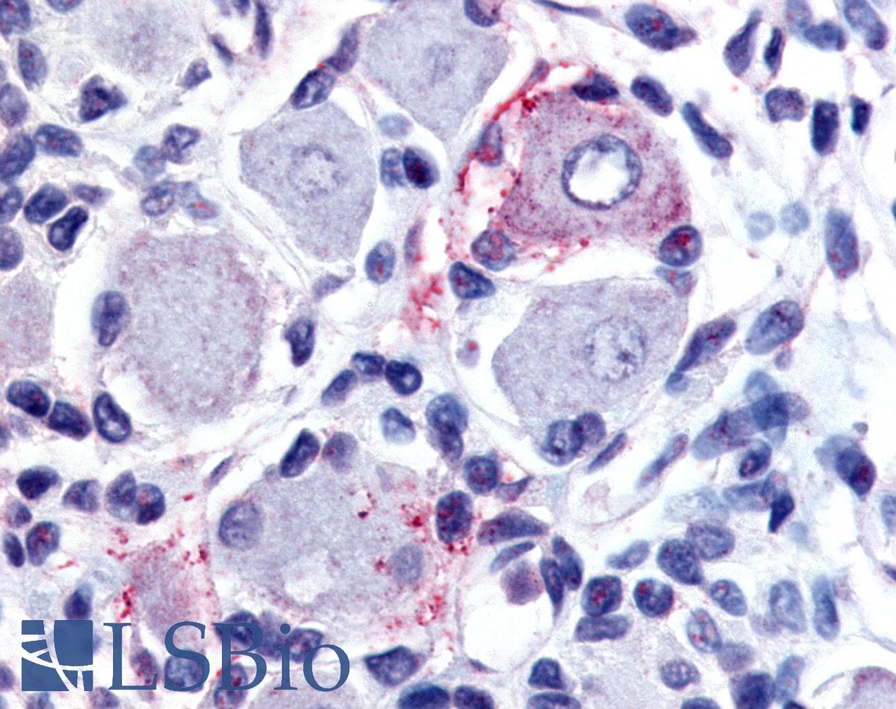 IHC-plus™ Polyclonal Rabbit anti-Human GPR149 / PGR10 Antibody (Cytoplasmic Domain, IHC)