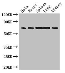 ENTPD7 Antibody
