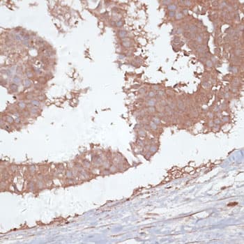 TGFBR2 Antibody