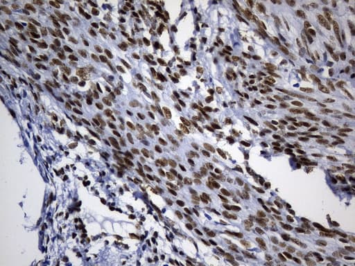 TLE1 / TLE 1 Antibody (aa180-460, clone UMAB253, Carrier-free)
