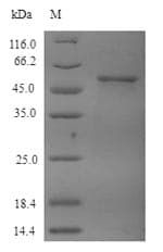 Human TUBB4 / Tubulin Beta 4 Protein (Recombinant 6His, N-terminus)