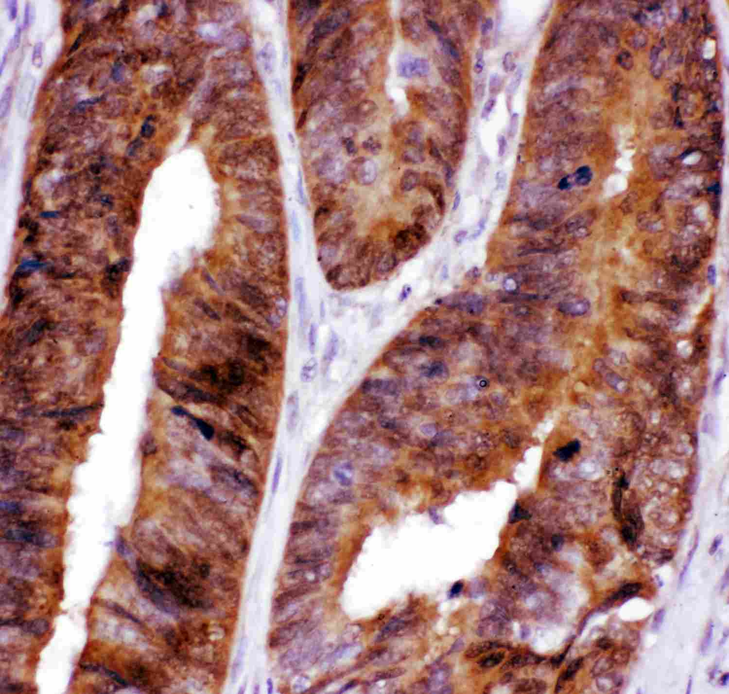 FOXO3 / FOXO3A Antibody (aa471-673)