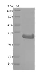 Mouse SAP130 Protein (Recombinant 6His, N-terminus)
