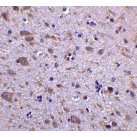 Polyclonal Rabbit anti-Human IRGM / LRG-47 Antibody (IHC, IF, WB)