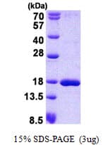 Human SSBP1 / mtSSB Protein (Recombinant His)
