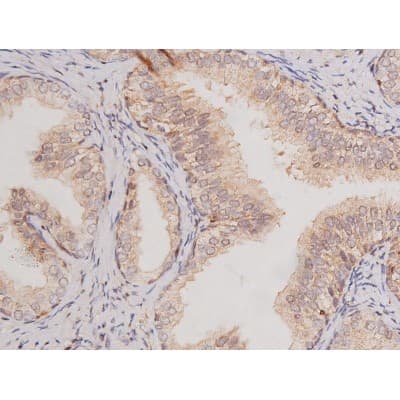 Polyclonal Rabbit anti-Human c-Kit / CD117 Antibody (IHC, IF, WB)
