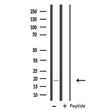 RPS18 / Ribosomal Protein S18 Antibody