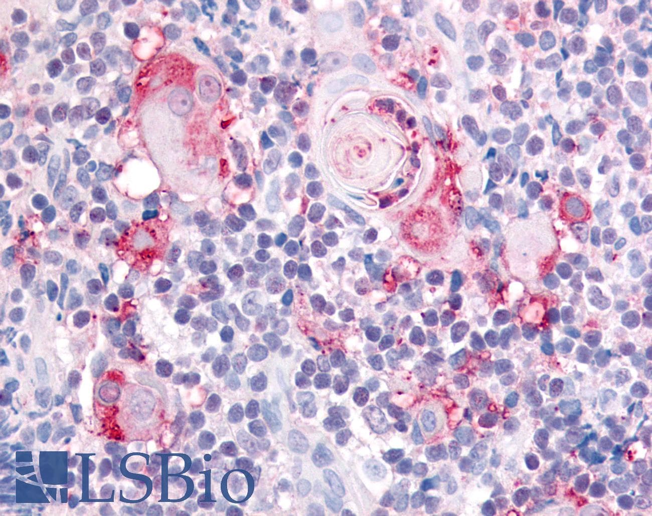 IHC-plus™ ITGA2 / CD49b Antibody (Extracellular Domain)