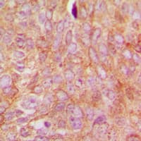 Polyclonal Rabbit anti-Human ARHGDIA / RHOGDI Antibody (C-Terminus, IHC, WB)
