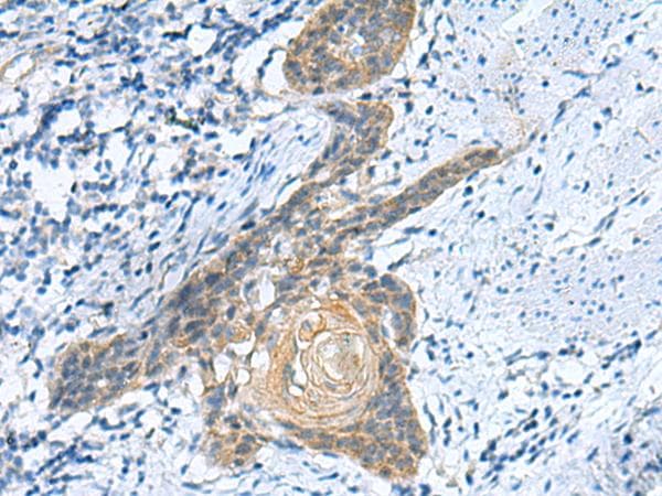 Polyclonal Rabbit anti-Human GINS3 Antibody (IHC)