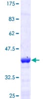 Human SNCA / Alpha-Synuclein Protein (Recombinant GST)