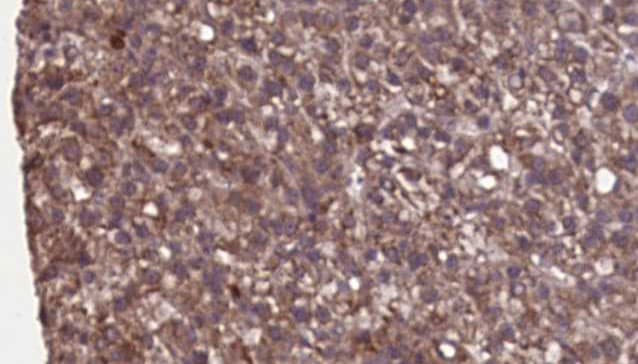 Polyclonal Rabbit anti-Human CYBB / NOX2 / gp91phox Antibody (IHC, WB)