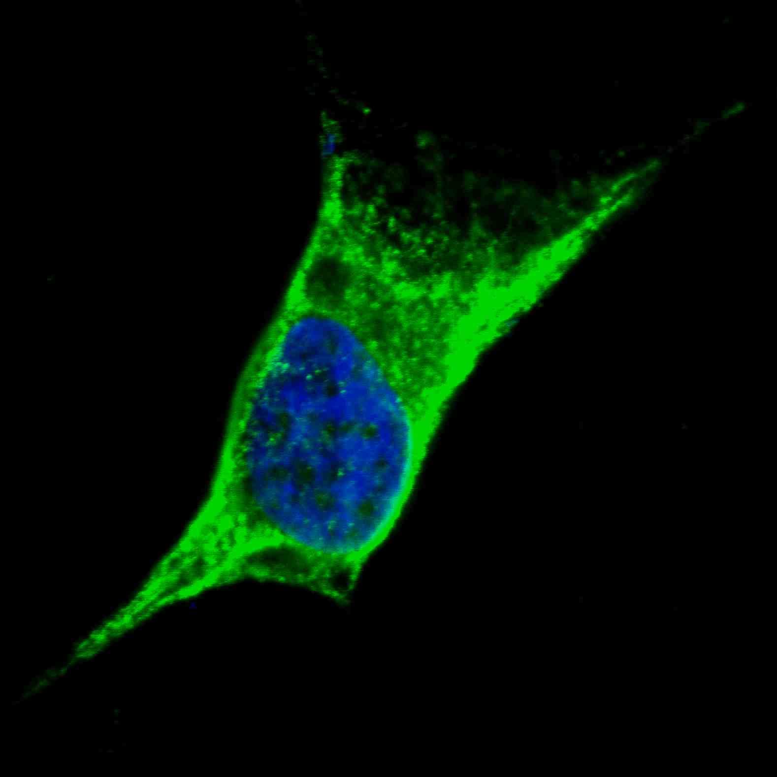 Polyclonal Rabbit anti-Human Vimentin Antibody (aa430-457, IHC, IF, WB)