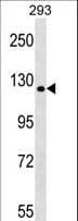 TBC1 / TBC1D1 Antibody (aa617-645)