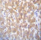 Polyclonal Rabbit anti-Human FASTK / FAST Antibody (aa395-424, IHC, WB)