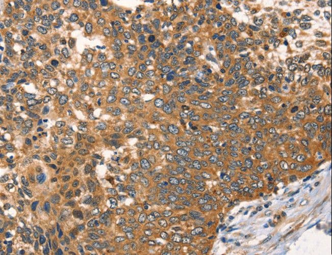 Polyclonal Rabbit anti-Human AGO1 / EIF2C Antibody (IHC)
