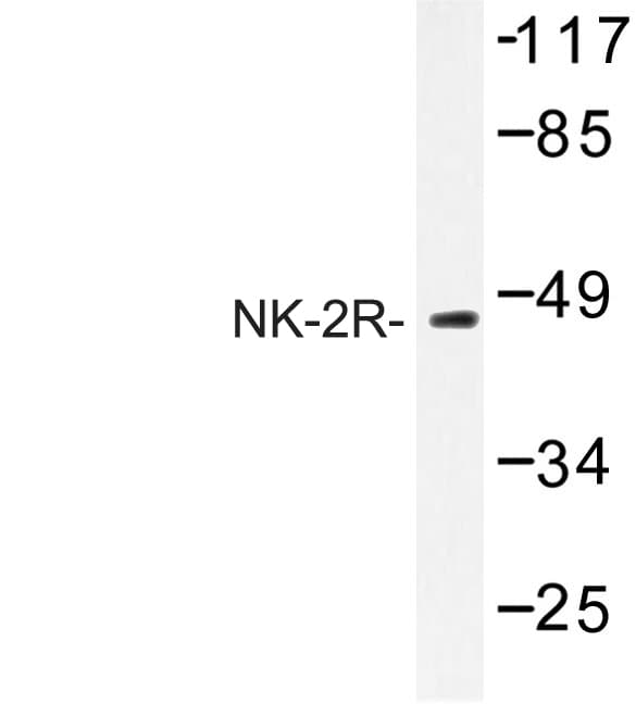 Polyclonal Rabbit anti-Human TACR2 / NK2R Antibody (Pro340, IF, WB)