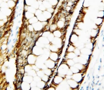 Polyclonal Rabbit anti-Human TIMP1 Antibody (aa189-207, IHC, WB)