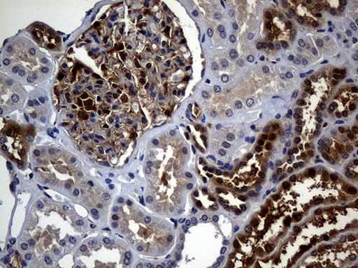 Monoclonal Mouse anti-Human M-PST / STM Antibody (clone OTI3G5, IHC, WB)