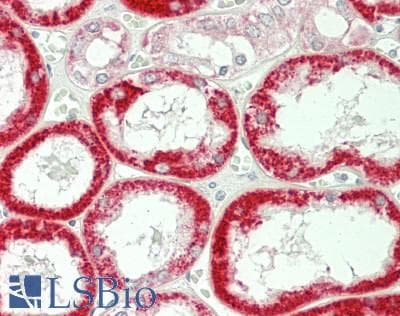 IHC-plus™ ATP1A1 Antibody (Internal)