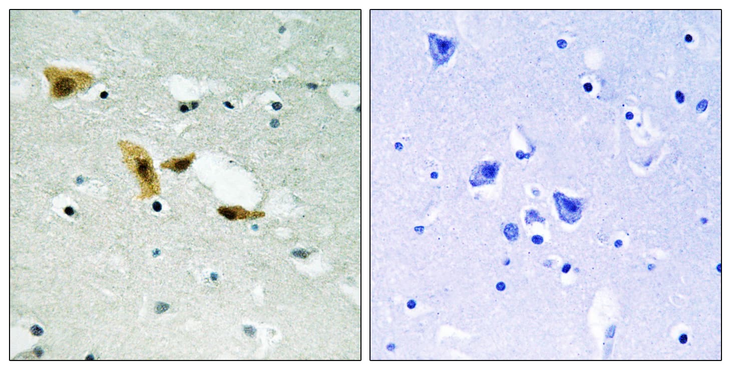 APLF / PALF Antibody (aa82-131)
