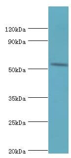 HYAL2 Antibody (aa367-473)