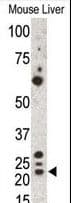 GREM1 / Gremlin-1 Antibody (aa147-175)