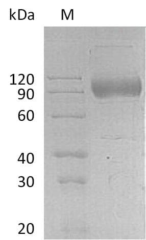 Human IL17RA Protein (Recombinant Fc, C-terminus)