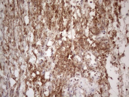 NR2C2 / TAK1 Antibody (aa1-241, clone OTI4B1)