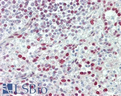 IHC-plus™ Polyclonal Rabbit anti-Human CDK15 / ALS2CR7 Antibody (IHC, WB)