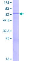 Human SDR9C1 / BDH1 Protein (Recombinant GST)