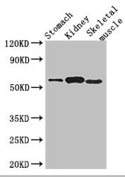 PPM1H Antibody