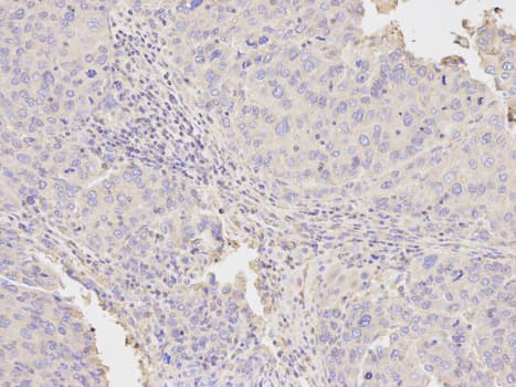 Polyclonal Rabbit anti-Human NAMPT / Visfatin Antibody (IHC, IF, WB)