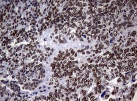 NBN / Nibrin Antibody (clone OTI1F11)