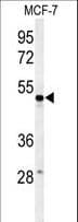 PSG7 Antibody (aa265-293)
