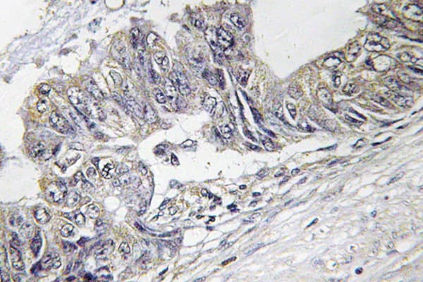 JNK1+2+3 Antibody (phospho-Thr183)