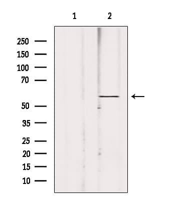 Polyclonal Rabbit anti-Human ACBD5 Antibody (IF, WB)
