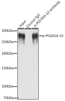 POLR2A / RNA polymerase II Antibody (phospho-Ser2)