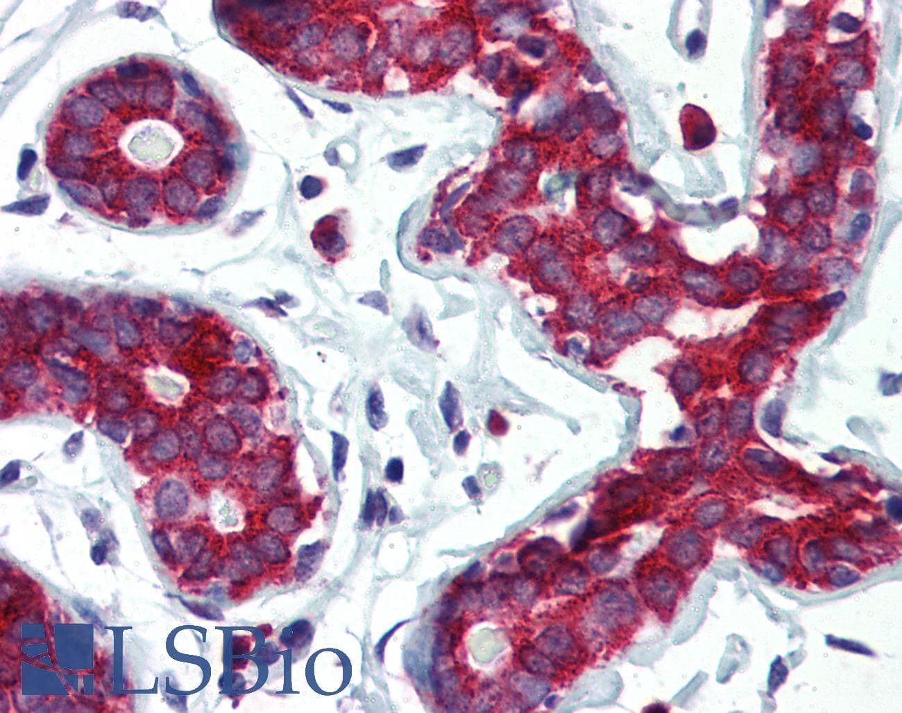 IHC-plus™ Monoclonal Mouse anti-Human TPD52L1 Antibody (clone D1C5, IHC, WB)