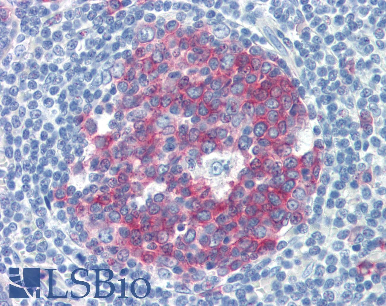 Polyclonal Rabbit anti-Human NCOA3 / SRC-3 / AIB1 Antibody (aa576-625, IHC, WB)