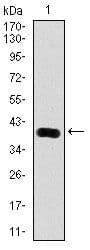 PSA-ACT Complex Antibody (clone 8A12)