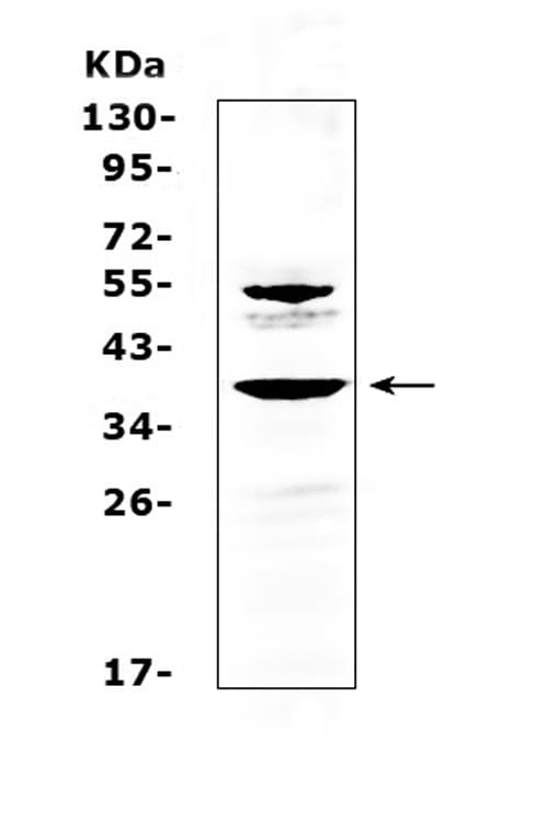 AMD / AMD1 Antibody