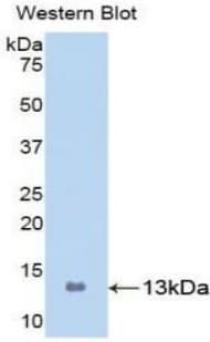 S100A8 / MRP8 Antibody (aa1-93)