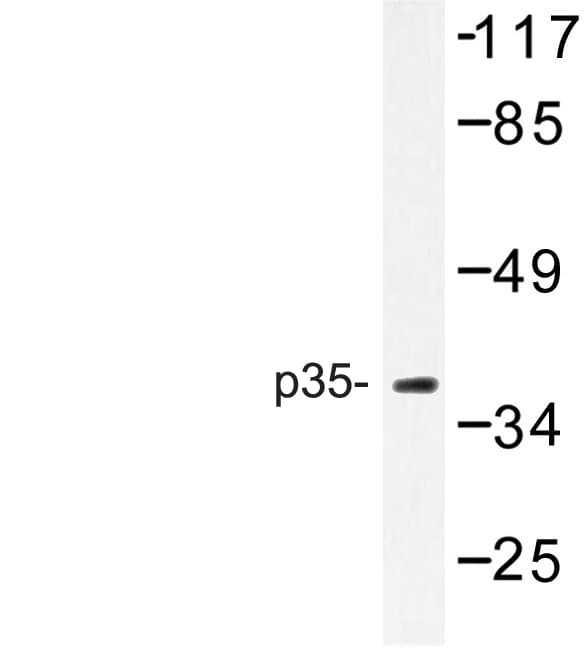 CDK5R1 Antibody (Gln31)