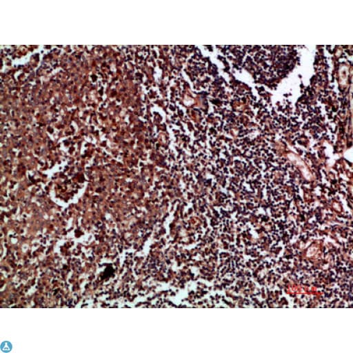 Polyclonal Rabbit anti-Human CDK6 Antibody (IHC, WB)